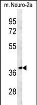 TNFAIP1 Antibody (C-term)