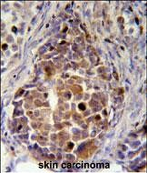 RDH16 Antibody (N-term)