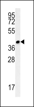 CC106 Antibody (Center)
