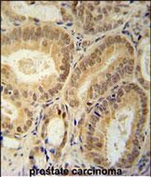 RBM24 Antibody (N-term)