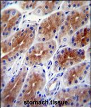 SAMD9 Antibody (C-term)