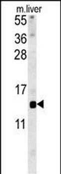 GAL Antibody (C-term)