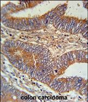 BIN2 Antibody (N-term)
