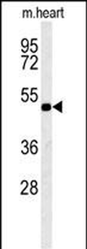 KCNV1 Antibody (N-term)