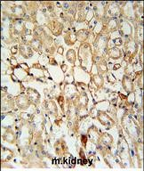 KCNV1 Antibody (N-term)