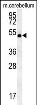 SHISA7 Antibody (Center)