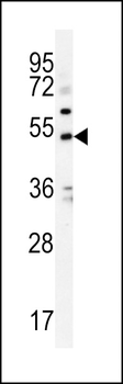 KCNJ6 Antibody (Center)