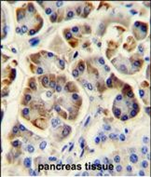 KCNJ6 Antibody (Center)