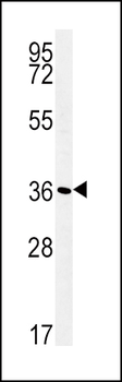 ATP1B1 Antibody (Center)
