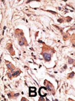 MAGED1 Antibody (Center)