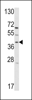 RAI3 Antibody (C-term)