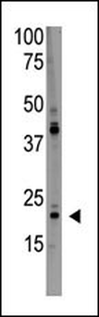 PDAP1 Antibody (C-term)