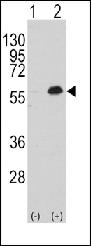 MEF2C Antibody (T300)