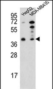 PARP16 Antibody (C-term)