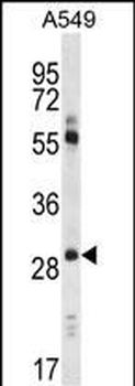 Claudin 1 (CLDN1) Antibody (Loop1)