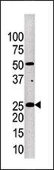 Kallikrein 4 (KLK4) Antibody (Center)
