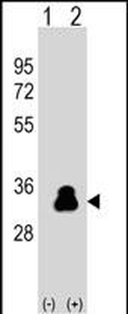 Kallikrein 4 (KLK4) Antibody (Center)