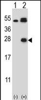 Kallikrein 6 Antibody (Center)