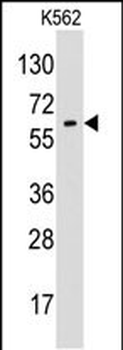 Glypican 6 (GPC6) Antibody (N-term)