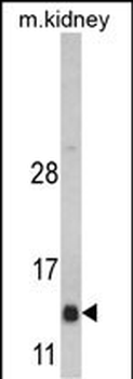 DNAJC19 Antibody (Center)
