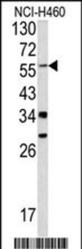 YAP1 Antibody (C-term)
