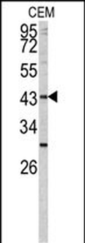 FUT1 Antibody (Center)