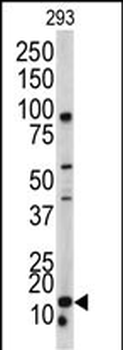 BAALC Antibody (N-term)