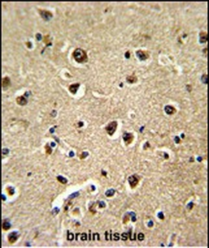 BAALC Antibody (N-term)