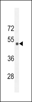 Sestrin-2 Antibody (Center)