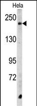 CPD Antibody (C-term)