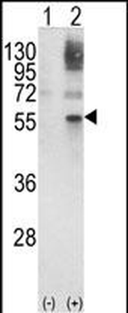 GATA2 Antibody (Center)