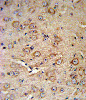 CRHR2 Antibody (N-term)