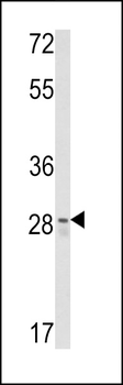 CUEDC2 Antibody (C-term)