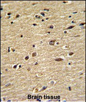 CUEDC2 Antibody (C-term)