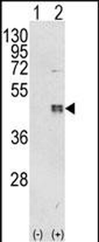 CEBPB Antibody (C-term)