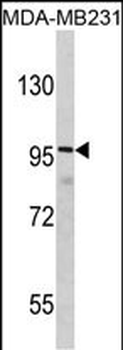 DLGAP1 Antibody (N-term)