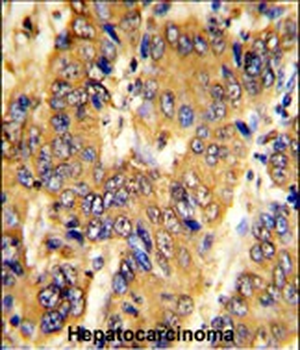 MSRB2 Antibody (Center)