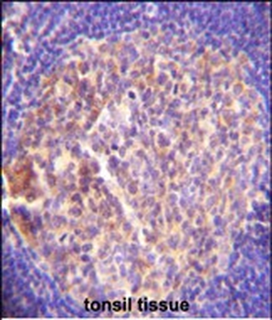 GRK6 Antibody (C-term)