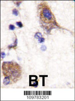 SCYL2 Antibody(C-term)