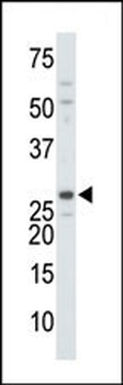 DTYMK Antibody (C-term)