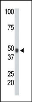 CHK Antibody (N-term)