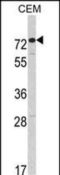 AMHR2 Antibody (C-term)