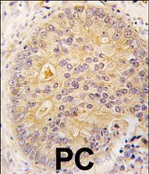 CAMKK2 Antibody (N-term G67)