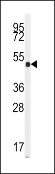 Guanylyl Cyclase alpha 2 (GUCY1A2) Antibody (N-term)