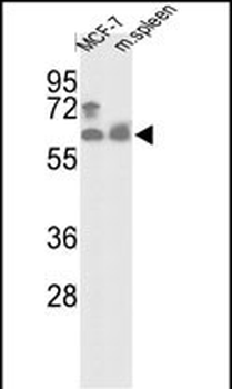 PANK1 Antibody (N-term)