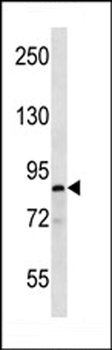 MARK Antibody (C-term)