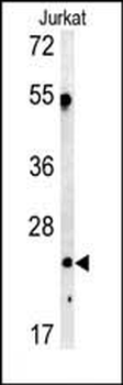 C1QA Antibody (C-term)