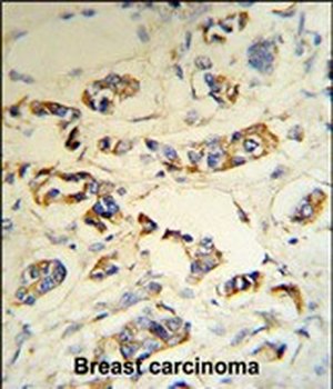 C1QA Antibody (C-term)