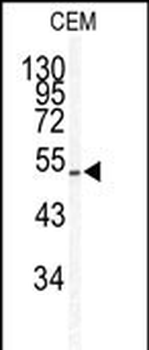 KLF5 Antibody (Center)