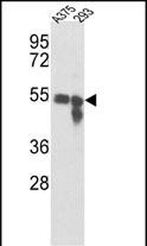 TYR Antibody (Center)